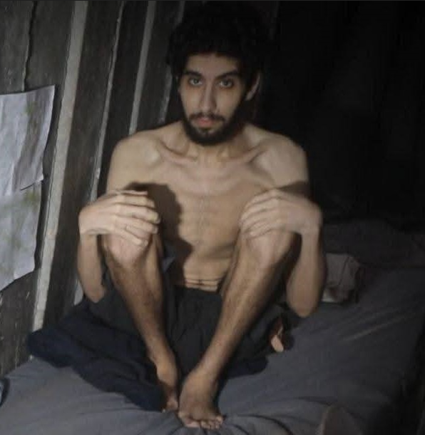 668 ימים של הרעבה מכוונת: דו"ח רפואי חושף סכנת מוות מיידית לחטופים בעזה-תמונה