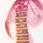 דורכים במקום: סכנה בריאותית-תמונה