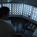 מניעת אירוע מוחי-תמונה