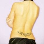 ניתוחי הרזיה - הקלה בכאבי גב?-תמונה