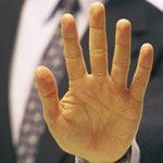 הרופאים הפגינו, רופא נוסף הותקף