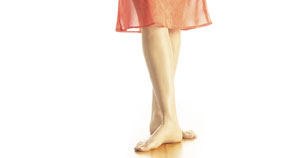 לימפדמה - בצקת לימפטית - מה עושים עם זה?-תמונה