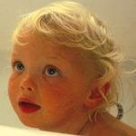 מניעת כוויות בילדים: איך תשמרו על ילדיכם-תמונה