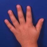 איך עוצרים עצירות?