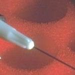 פוחדים מזריקות-תמונה