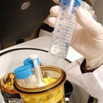 מחלת גושה-תמונה