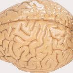 שאלות נפוצות מפורום טרשת נפוצה-תמונה