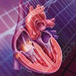 אירוע ומחלות לב - כל המידע והעובדות-תמונה