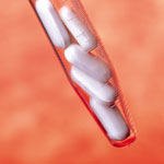 חדשות סרטן השד-תמונה