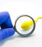 השבחת זרע - תמונת אווירה