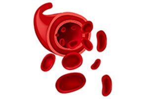 מיאלומה נפוצה: מקטלנית - לכרונית-תמונה