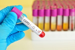 G6PD: האנזים האבוד-תמונה