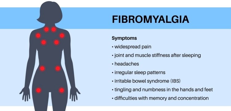 פיברומיאלגיה