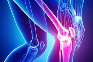 דלקת מפרקים: אבחון וטיפול-תמונה