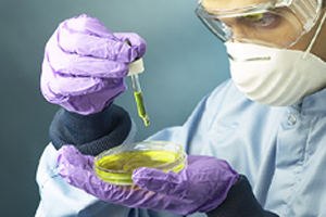 בדיקת נשאות HIV 