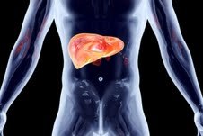 אושפז עקב צהבת מסוג E-תמונה