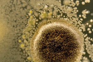 סוף לחיידקים העמידים?-תמונה