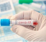 טיפולים תרופתיים כנגד COVID-19: הבטחות מול אכזבות-תמונה