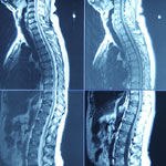 אורתופדיה: גב חשוף (לפגיעות)-תמונה