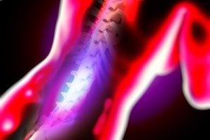 עקמת: SHILLA לצמיחה עם הילד-תמונה