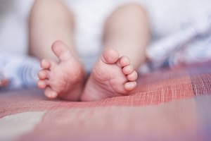 עיוותי רגליים אצל תינוקות וילדים (אילוסטרציה shutterstock)