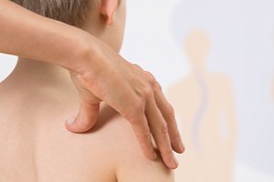 עקמת ילדים: חשיבות האבחון המוקדם-תמונה