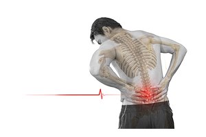 היצרות תעלת עמוד השדרה המותני-תמונה