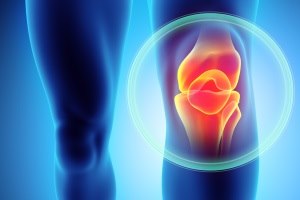 ניתוחי ברך נפוצים: מדריך-תמונה