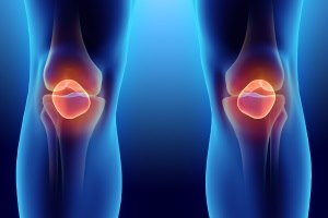טיפול בבעיות ברכיים: כל החידושים-תמונה