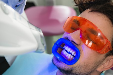 הדרך המהירה להלבנת שיניים היא בטיפול בקרן לייזר. צילום: שאטרסטוק