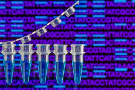 מבחנות PCR לאבחון גנטי טרום השרשה (אילוסטרציה shutterstock)