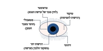 סיבוכי עדשות מגע (איור: ד"ר ניר ארדינסט)