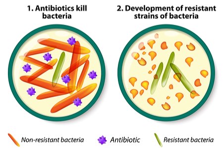 מנגנון היווצרות עמידות החיידקים לאנטיביוטיקה (אילוסטרציה shutterstock)