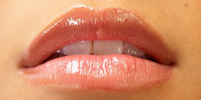 מילוי שפתיים (אילוסטרציה shutterstock)