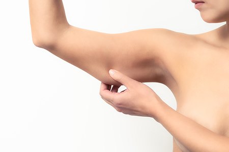 יש פתרונות לעור המתדלדל בזרועות (אילוסטרציה shutterstock)