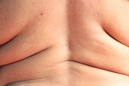 מתיחת בטן היקפית היקפית מותחת את כל הגוף, לרבות הגב. צילום: thinkstock