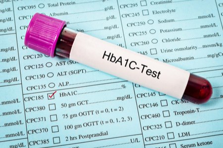 בדיקת המוגלובין מסוכרר (HbA1C) משקפת את ממוצע רמת הסוכר בדם ב-3 חודשים האחרונים. צילום: שאטרסטוק