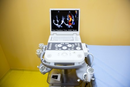 בדיקת אקו לב מספקת תמונה איכותית של כל חלקי הלב. צילום: thinkstock
