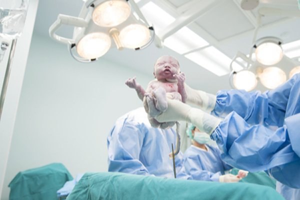 ניתוח קיסרי נחשב כהתערבות הניתוחית השכיחה ביותר בעולם. צילום: שאטרסטוק