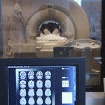 סוכרתיים ופגיעה מוחית