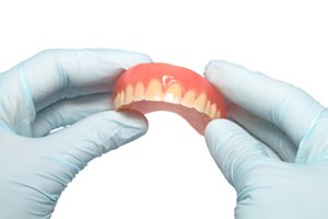 הקשר בין דלקת מפרקים לדלקת חניכיים (אילוסטרציה)