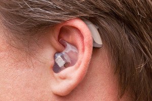 אוטוסקופיה - תמונת המחשה