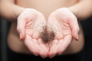 הקילוגרמים ירדו  והשערות נשרו?-תמונה