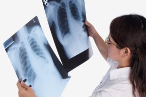 מודעות לקרינה המייננת (shutterstock)