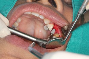 טיפולי שיניים בסיסים לחסרי מעמד בת'א (אילוסטרציה shutterstock)