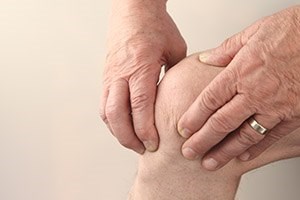 דלקת מפרקים שגרונית: מדריך-תמונה