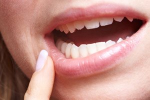 חריקת שיניים (אילוסטרציה: שאטרסטוק)