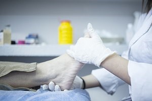 תסמונת דורבן העקב: איך תטפלו?-תמונה