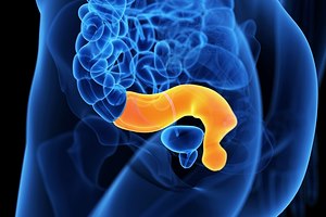 לפרוסקופיה בהריון - תמונת אווירה