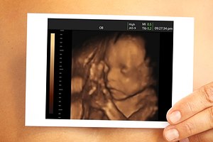 בדיקה: הערכת משקל העובר-תמונה